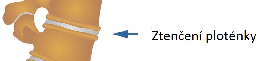 degen_dicsCZ5ztenceni 1083